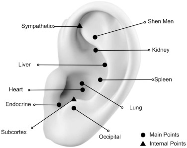 Acupuntura Auricular em Brasília: Preços, Pontos e Benefícios 1 Mapa de pontos da Auriculoterapia - Shen Men e outros pontos principais